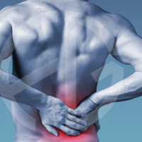 Sacroiliac-Joint-Dysfunction