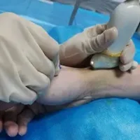 fsurg-09-1034716-g003